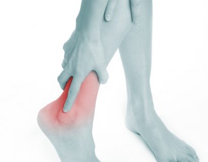 Venous Ulcers