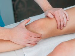 varicose vein removal