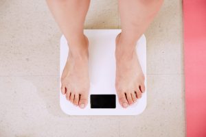 varicose veins and obesity