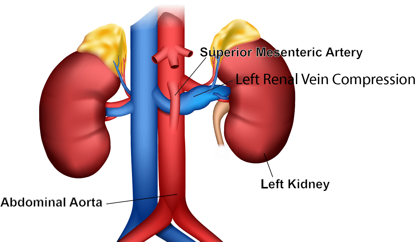 Deep Vein Thrombosis Treatment Macon