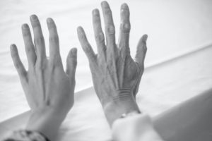 bulging hand veins
