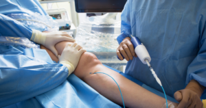 minimally invasive procedures to give you better veins for life