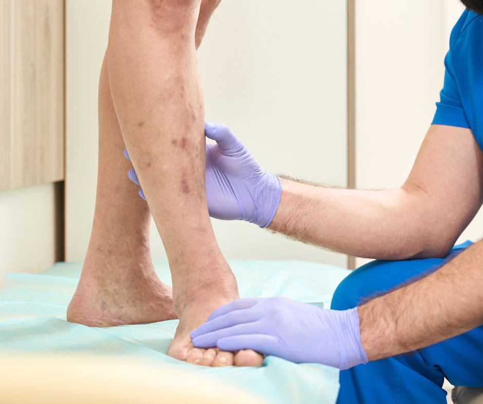leg health evaluation by a vein specialist
