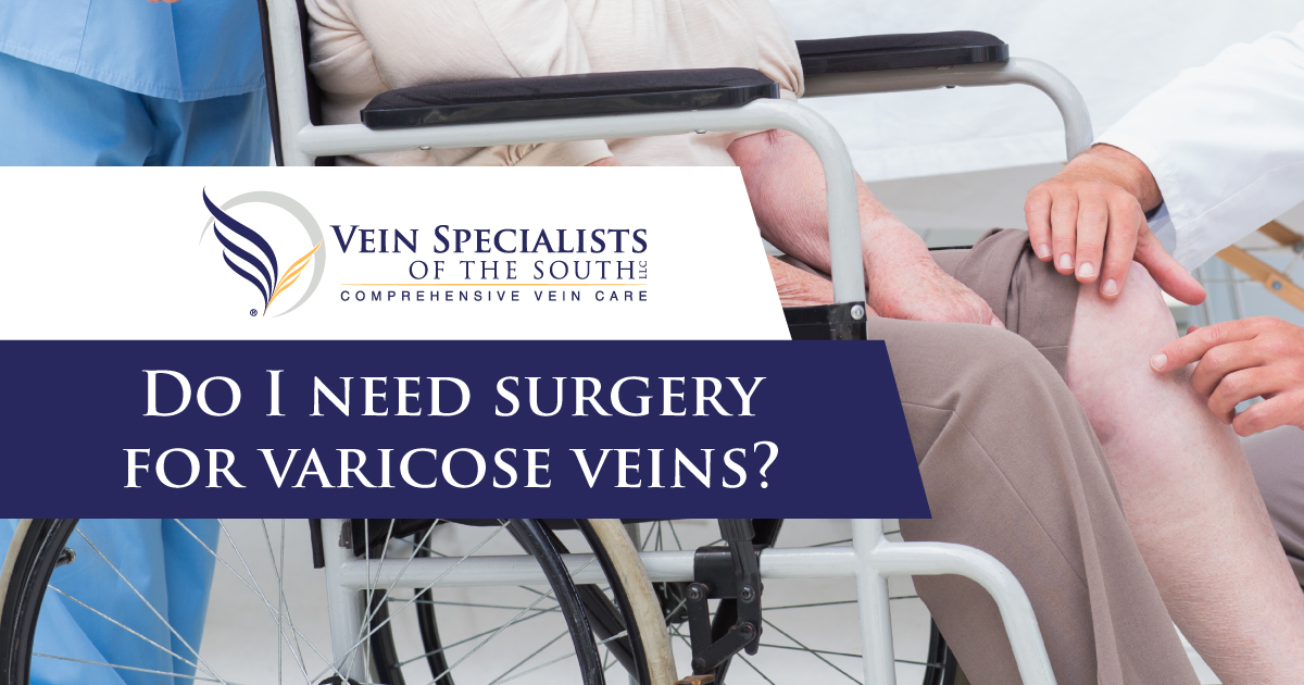 varicose vein surgery