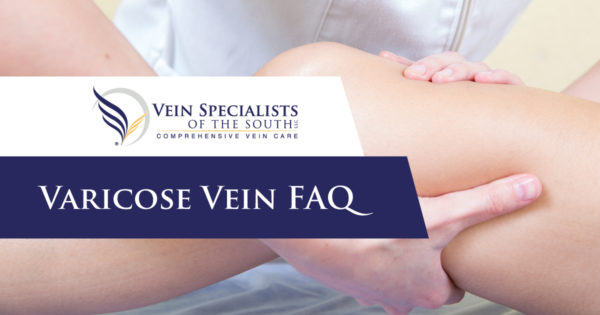 varicose vein questions