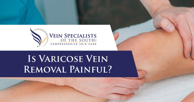 is varicose vein removal painful
