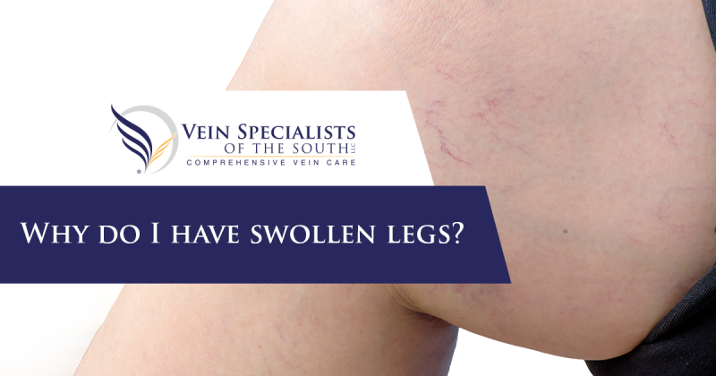 swollen legs georgia