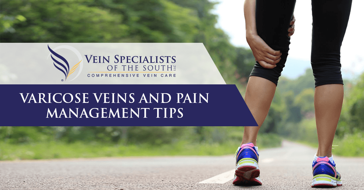 varicose veins pain relief