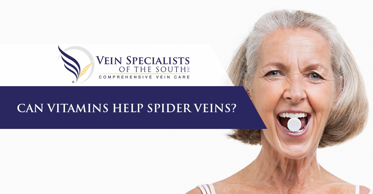 can vitamins help spider veins?