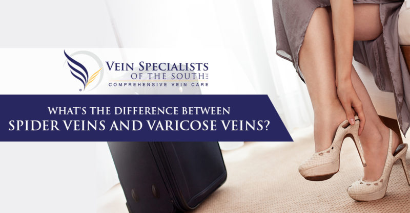spider veins and varicose veins