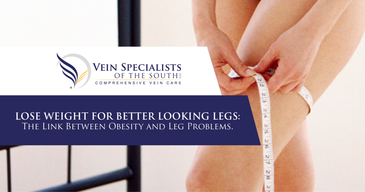 obesity and varicose veins