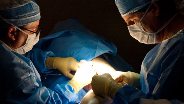 Ambulatory Phlebectomy