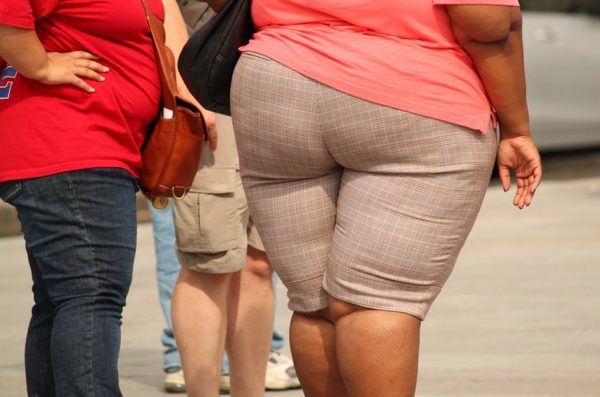 obesity and leg problems