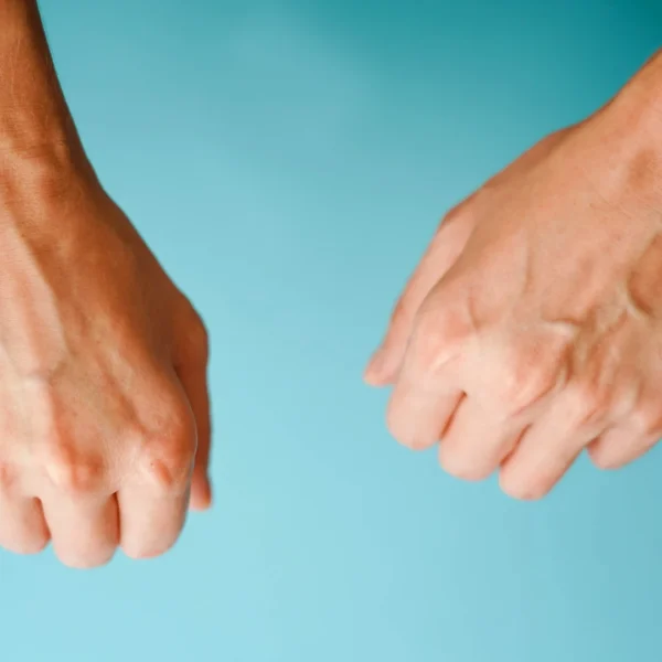 hand veins