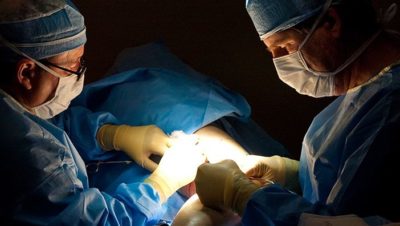 varicose vein treatment central georgia